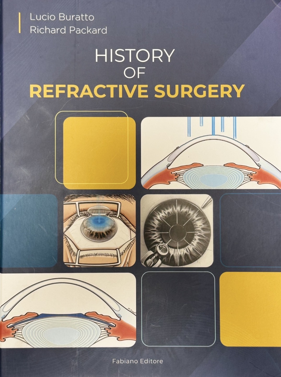 History of Refractive Surgery